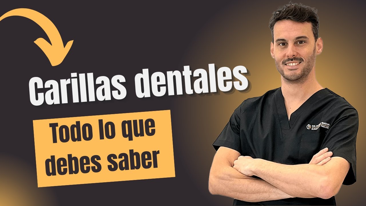 Todo sobre las Carillas Dentales (Tipos, Duración, Cuidados...) | Dr. Monero Baena