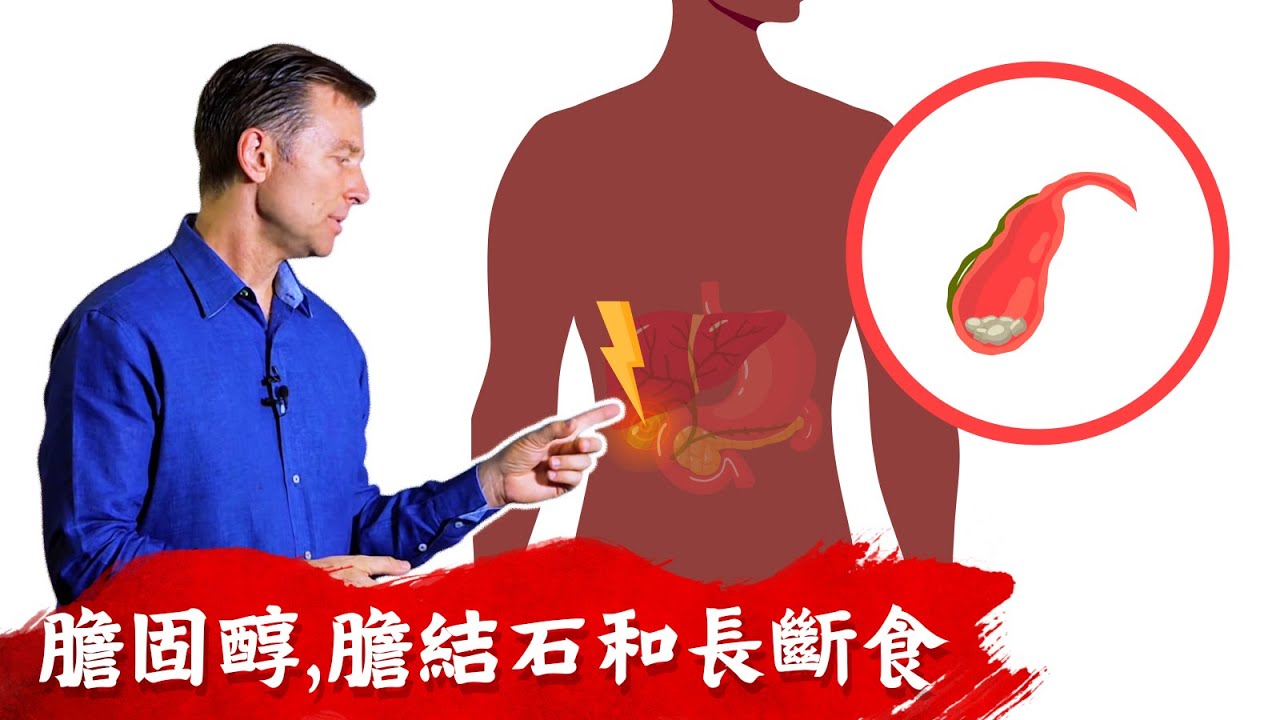 膽結石,高膽固醇,長斷食中吃膽鹽(膽囊配方),柏格醫生 Dr Berg