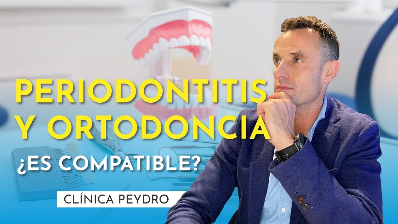 Tengo periodontitis, ¿puedo ponerme ortodoncia?
