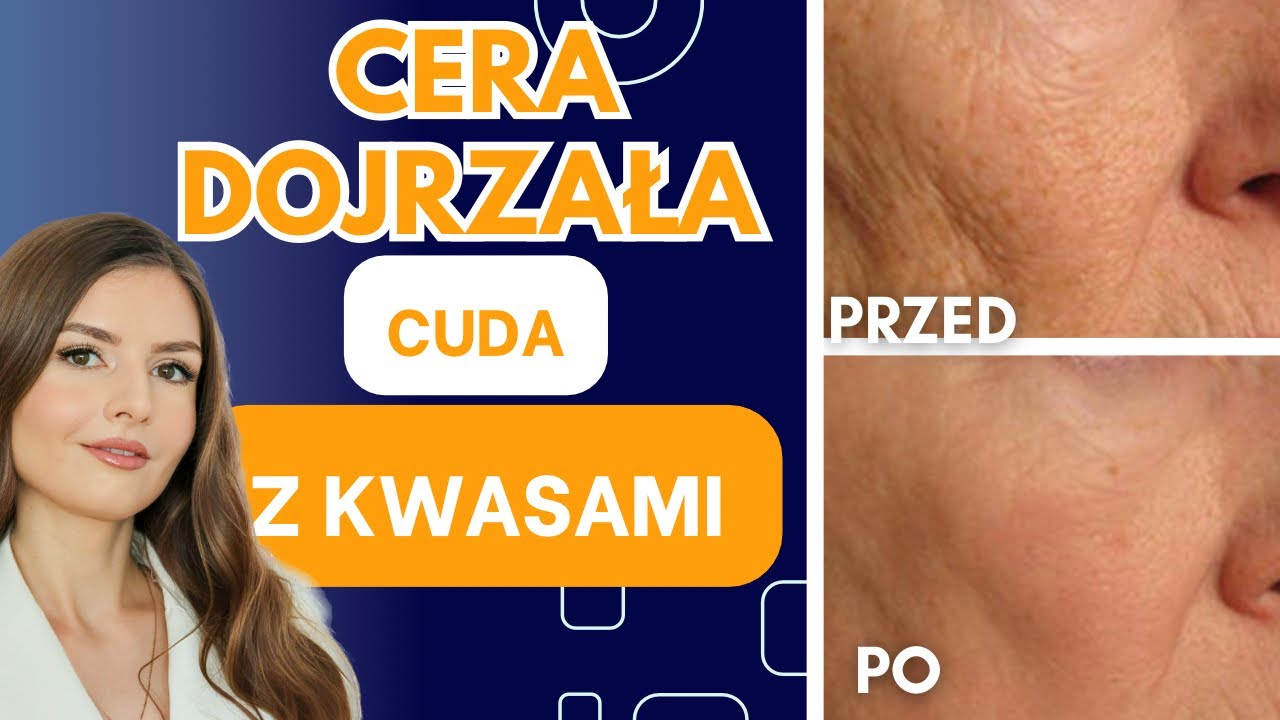 CERA DOJRZAŁA Pielęgnacja Anti-aging - Najlepsze Kosmetyki z Kwasami