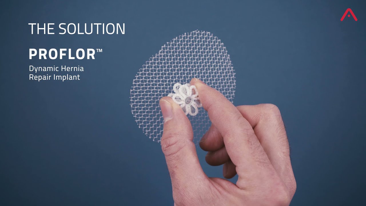 Leistenbruch &ndash; Implantat &bdquo;Proflor von Insightra Medical, Inc.&ldquo;