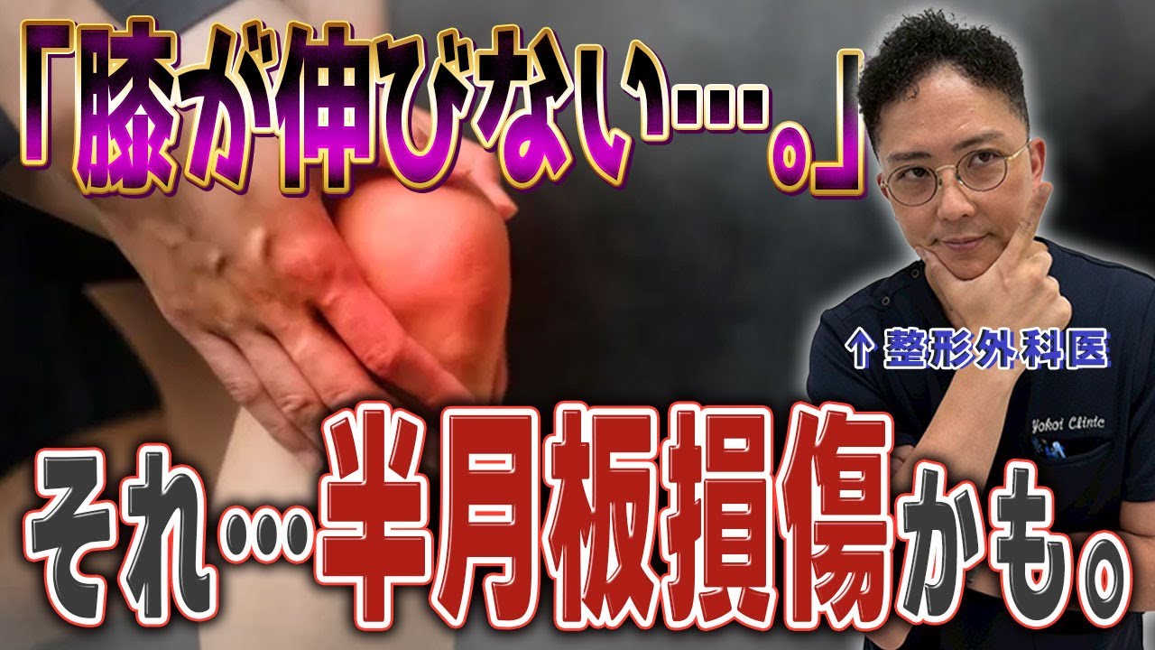 【半月板損傷の全て】多くの人が誤解している『半月板の役割』とは？原因から治療法まで、半月板損傷の全てを整形外科医が徹底解説！