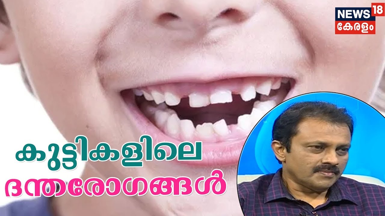 Dr Q : കുട്ടികളിലെ ദന്തരോഗങ്ങള്‍ | Dental Problems In Kids | 16th January 2019
