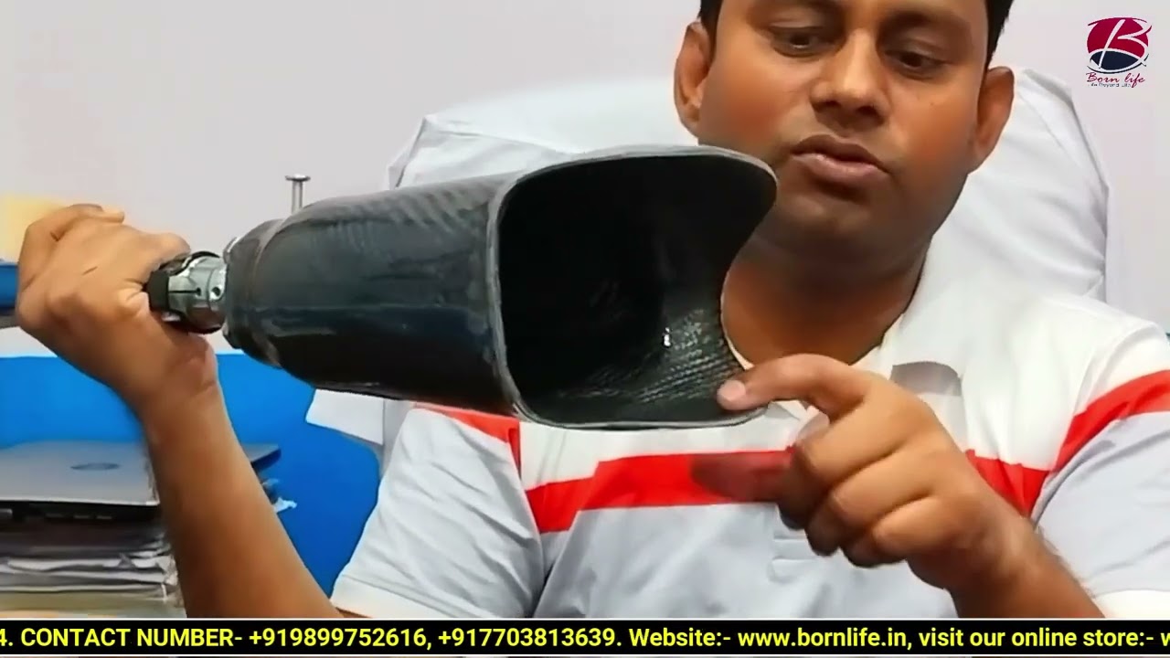 Below Knee Carbon socket and its features || Bornlife Artificial Limbs Center
