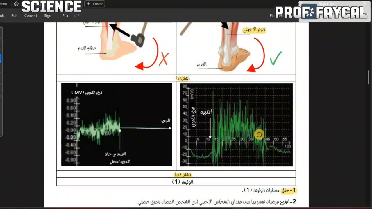 حل تمرين: التمزق العضلي السنة الثانية ثانوي علوم تجريبية