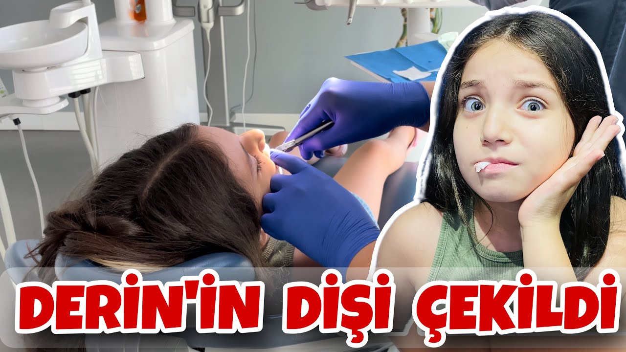 DERİN’İN DİŞİNİ ÇEKTİRDİK ! Derin Çok Ağladı Mı ?!
