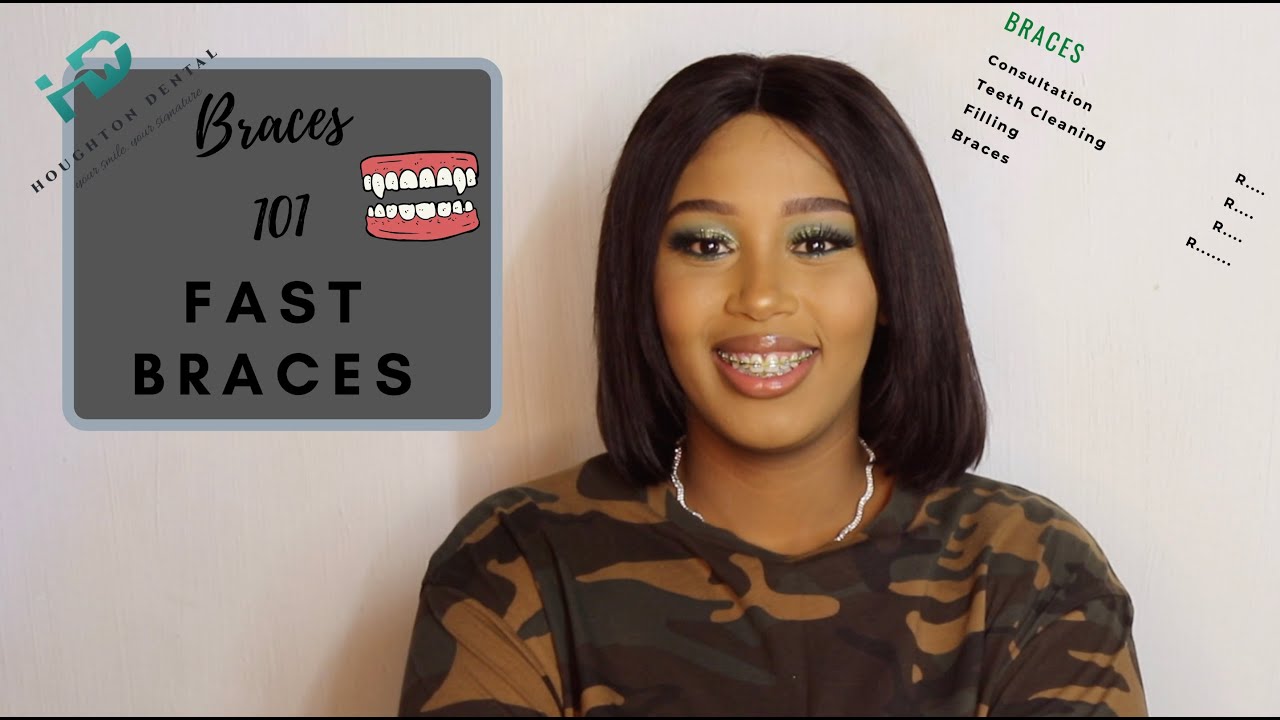 Everything you need to know about FAST BRACES!
