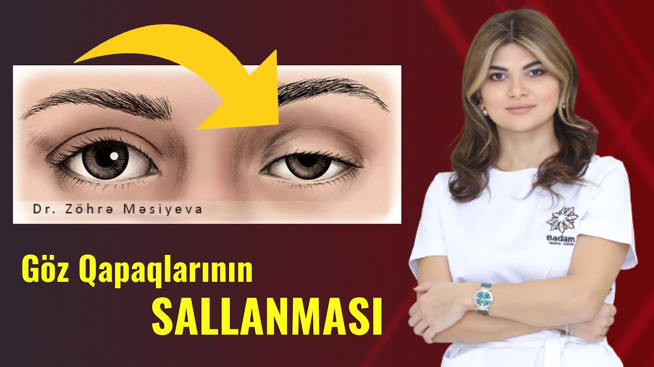 Göz Qapaqlarının Sallanması - Əməliyyatla Çarəsi