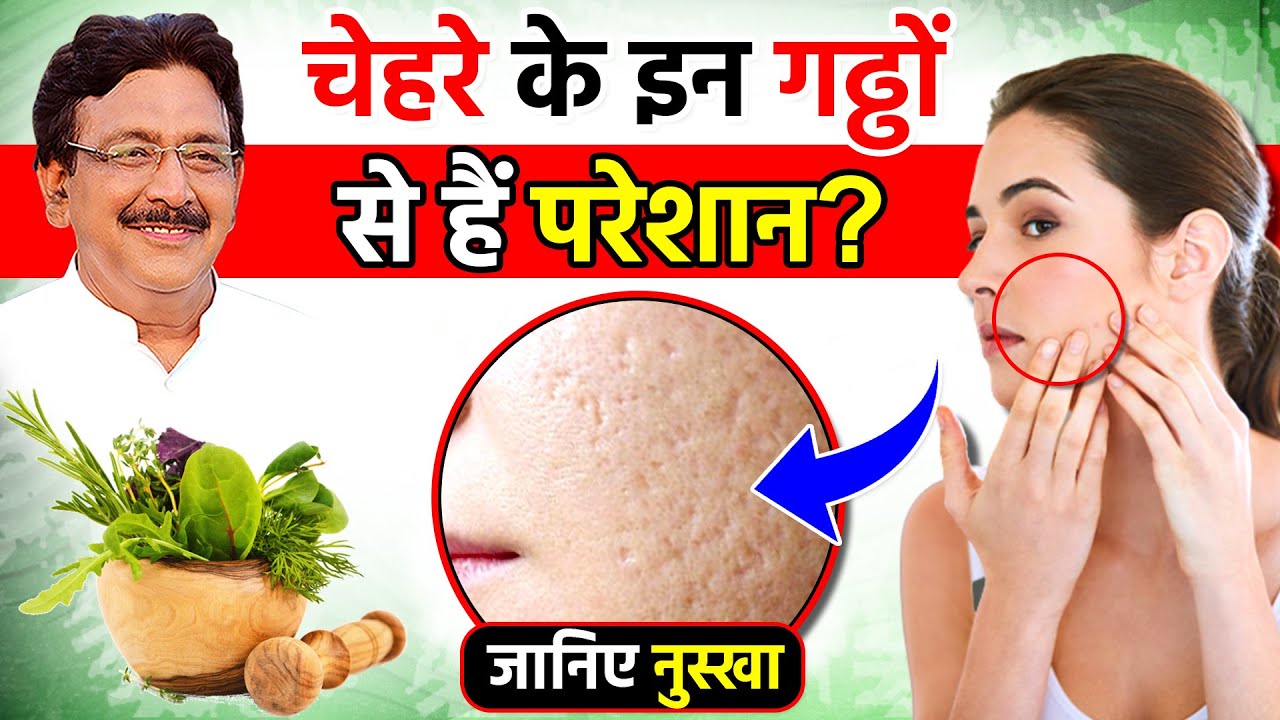 त्वाचा के OPEN PORES को घरेलू नुस्खों से करे कम |  | Hakim Suleman Khan | Unani