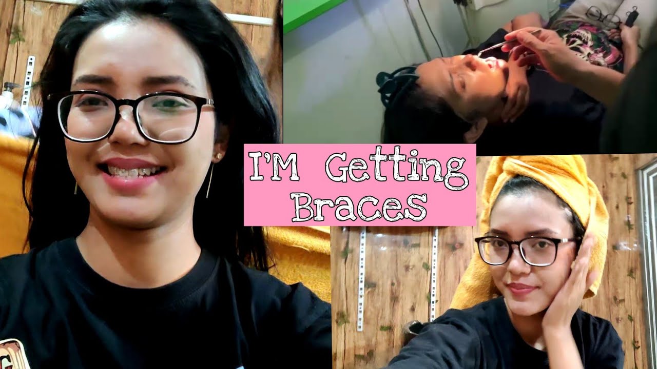 I got braces 😬🦷Ya Tara pharure ||  Why I took the decision?Braces pharaga last chicken bite