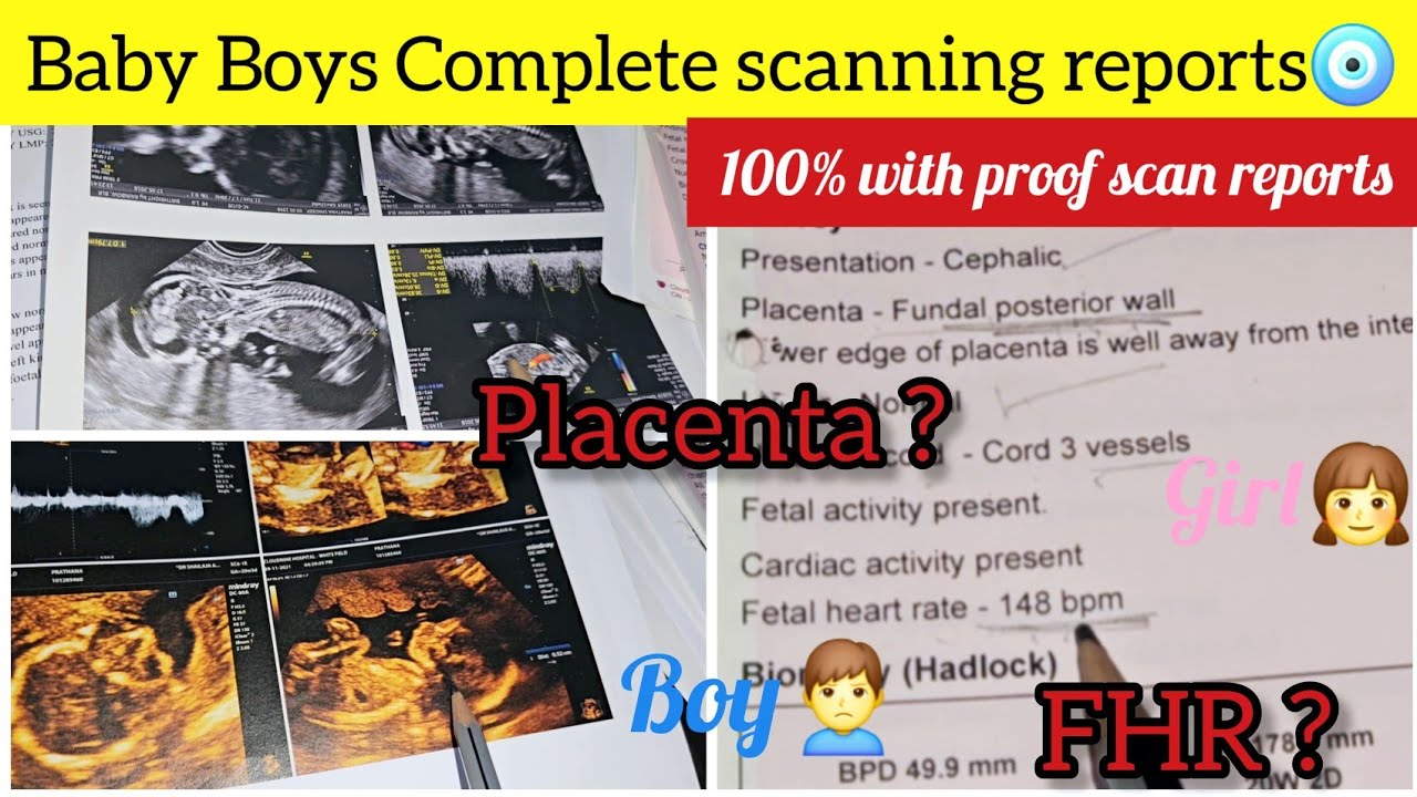 #Babyboy Scaning Report/How to Identify baby boy with heart Beat & Placenta Position?