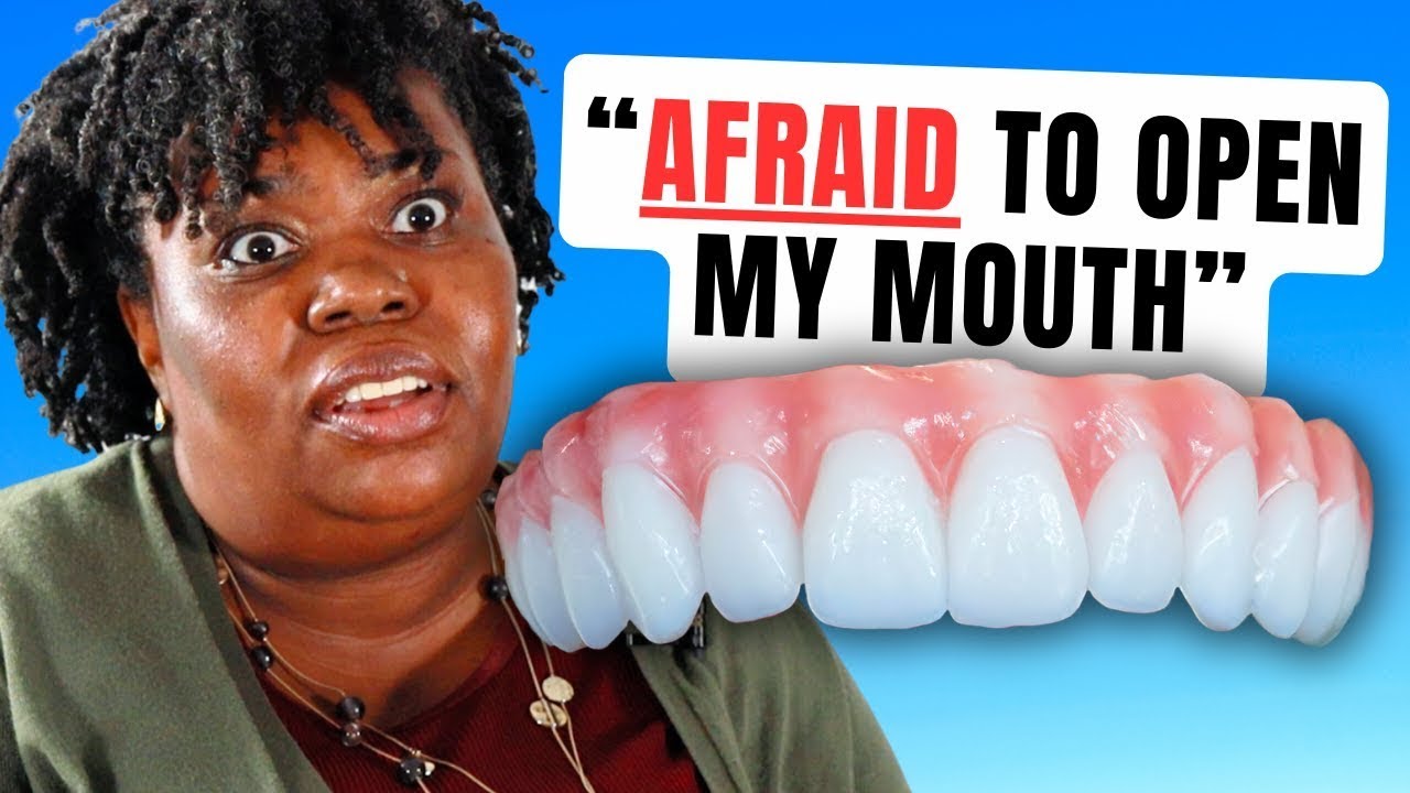 Life After Dental Implants: What I Wish I Knew