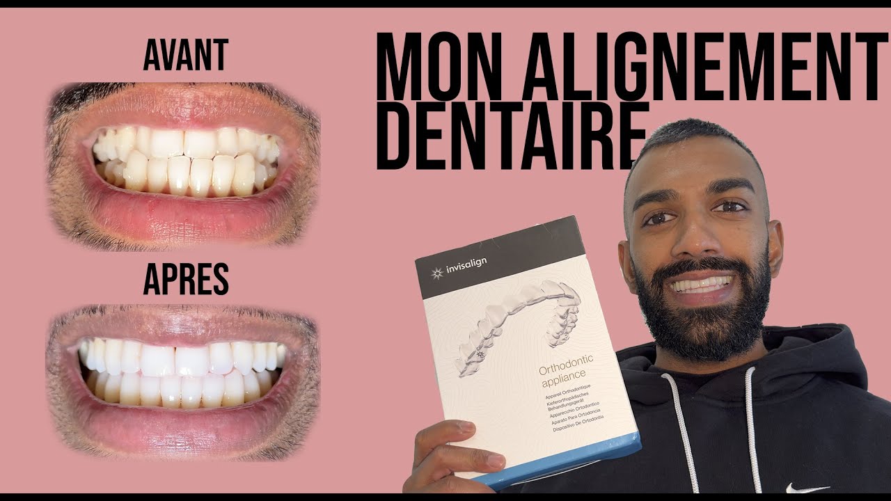 Mon alignement dentaire INVISALIGN