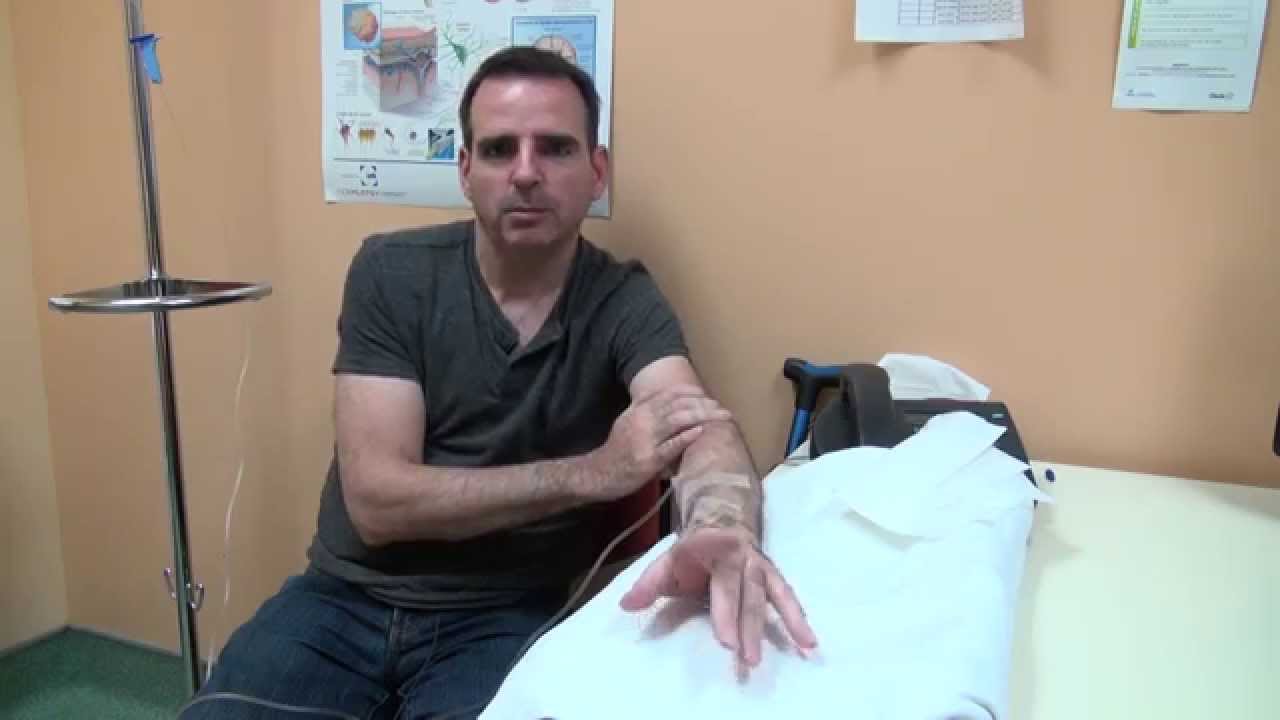 Sylvain, 48 ans, atteint de sclérose en plaques