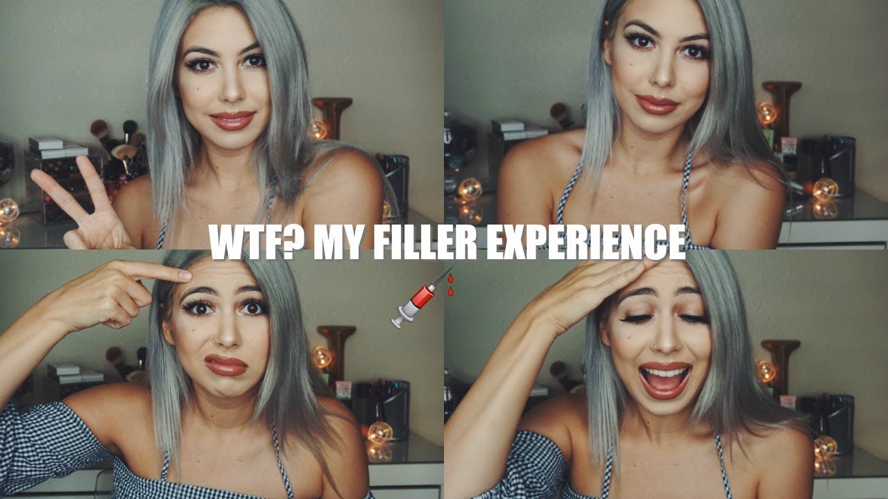 THERE'S A NEEDLE STUCK IN MY FOREHEAD?! | My Dysport/Filler Experience