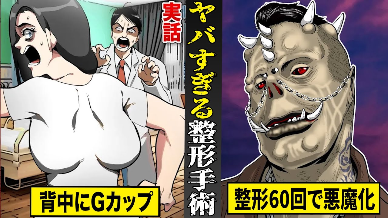 【実話】整形で人生終了！？ヤバすぎる整形手術特集。豊胸で背中にGカップ...整形６０回で悪魔化。