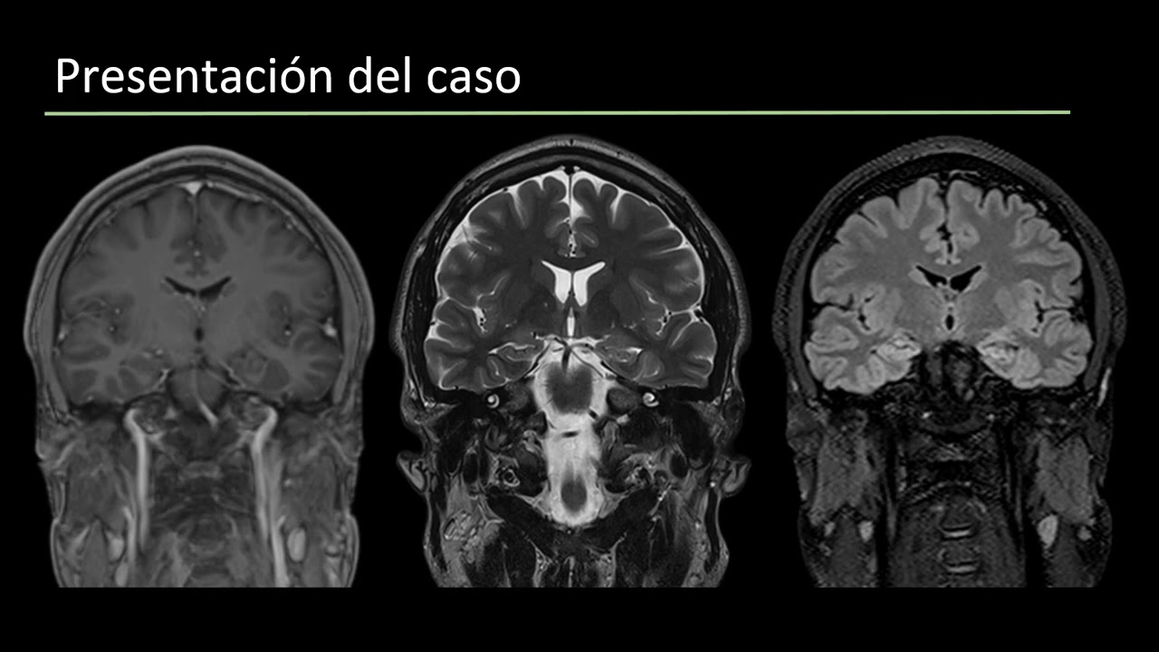 Caso del Mes n°237 Enero 2026 