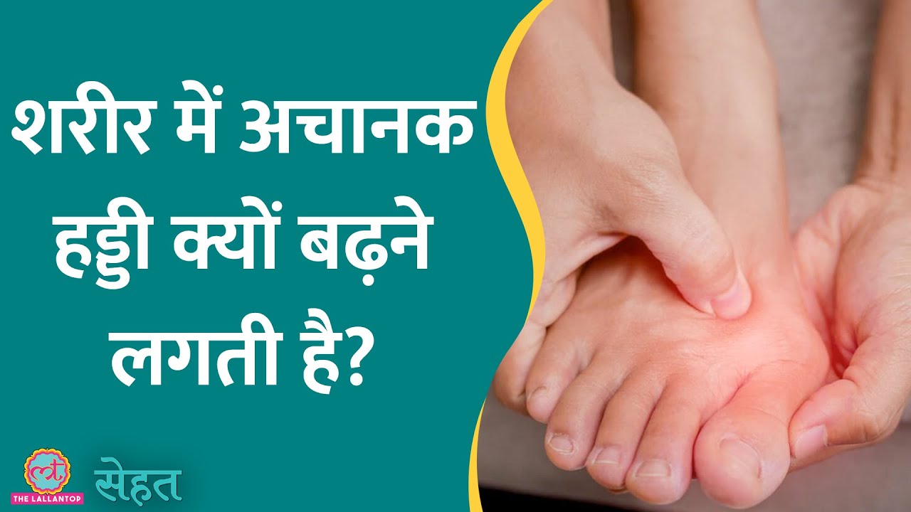 शरीर में अचानक हड्डी बढ़ने लगी है, ख़ासकर जोड़ों में? डॉ. से जानिए क्या है Bone Spur | Sehat ep 840