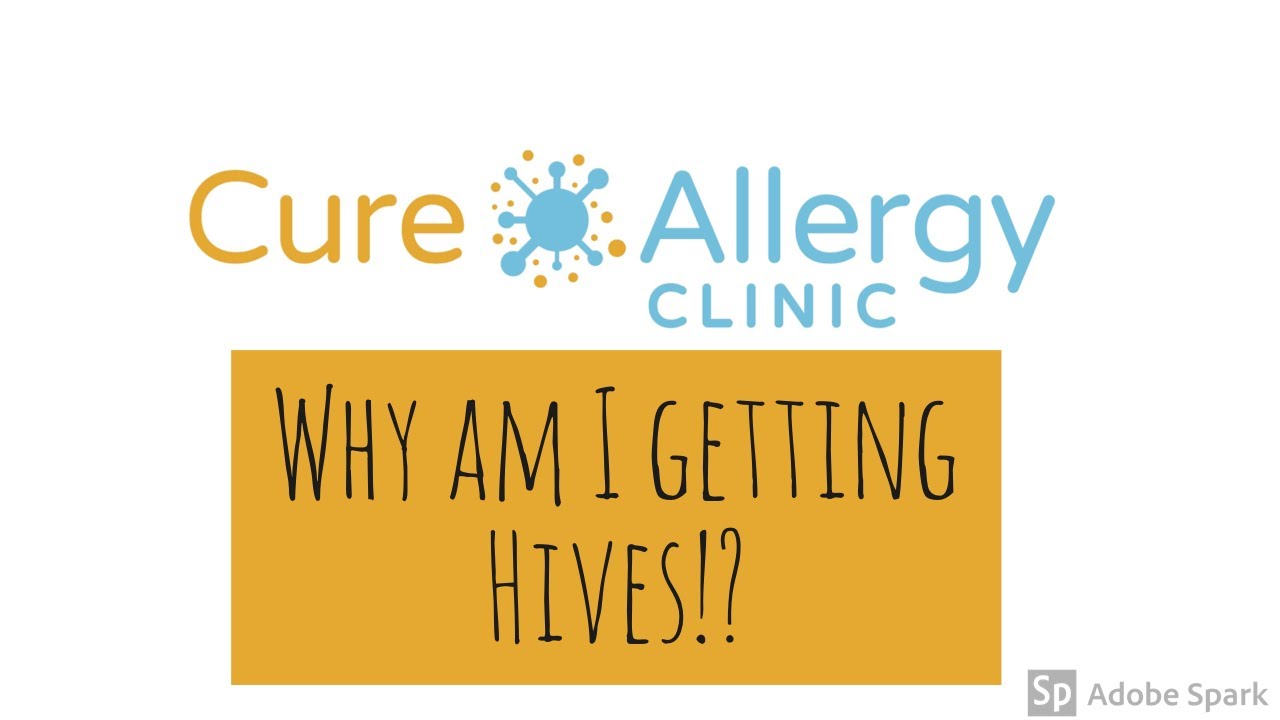Why am I getting Hives? | Allergist explains different causes