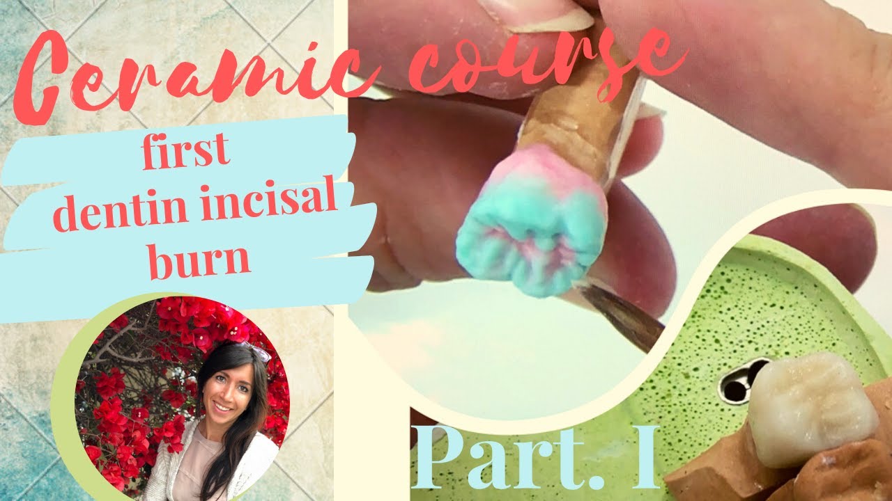 Dental Ceramic Layering - First Dentin Incisal Burning with HeraCeram [Tutorial - English]