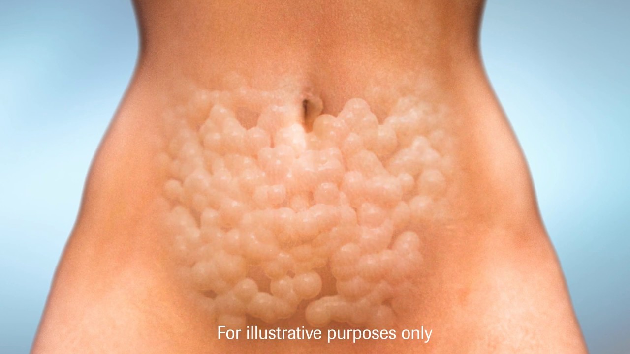 Fat Cell Volume And Growth