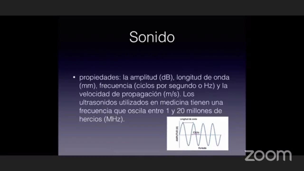 Ecocardiografía transesofágica intraoperatoria. WebinarSmact8.
