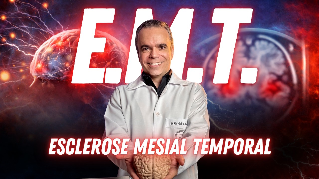 Esclerose Mesial Temporal: Entenda a Epilepsia do Lobo Temporal e os Sintomas
