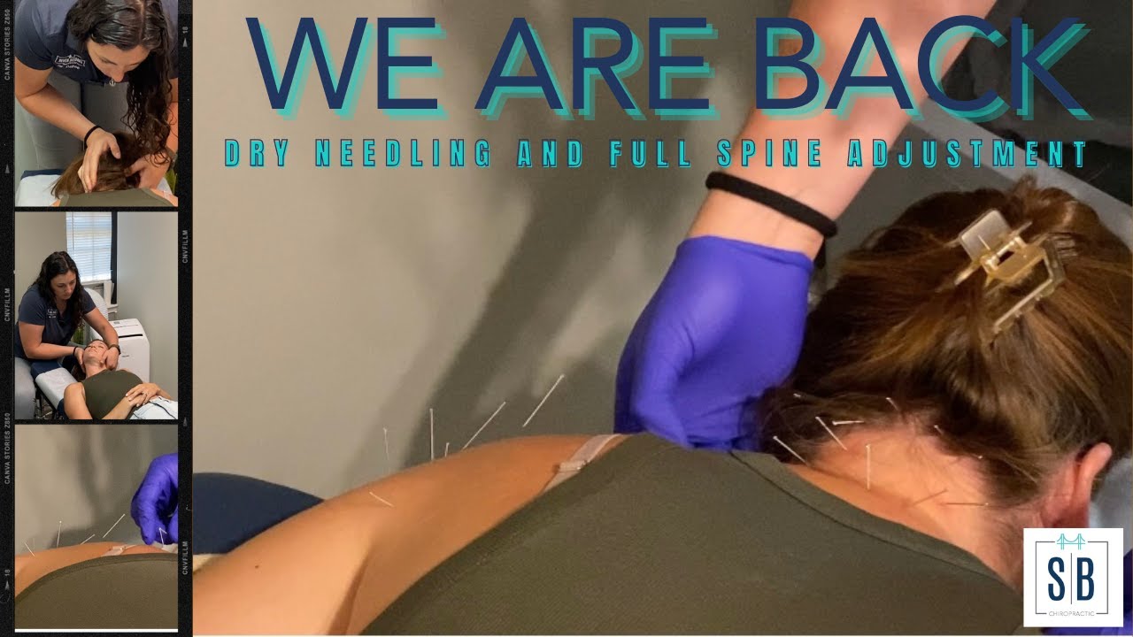JACKSONVILLE FLORIDA SPORTS ACUPUNCTURE, CUPPING AND FULL SPINE ADJUSTMENT