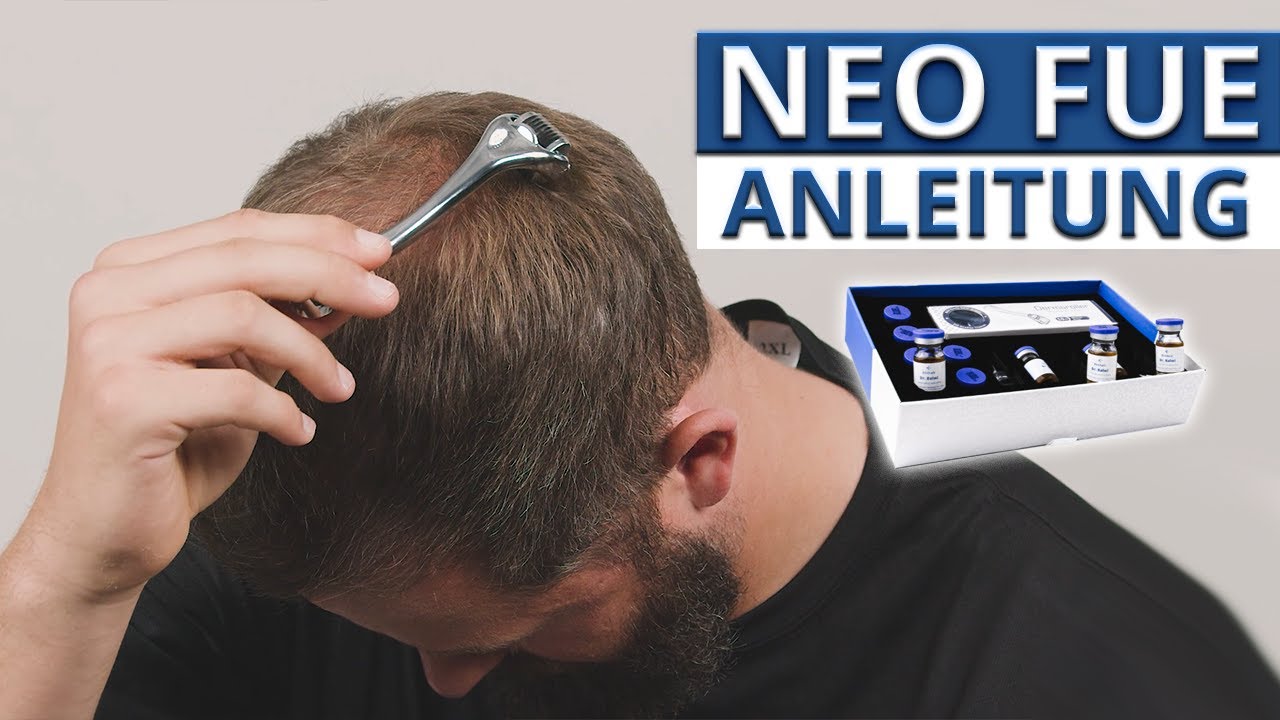 NEO FUE: Anleitung Anwendung & Vorteile