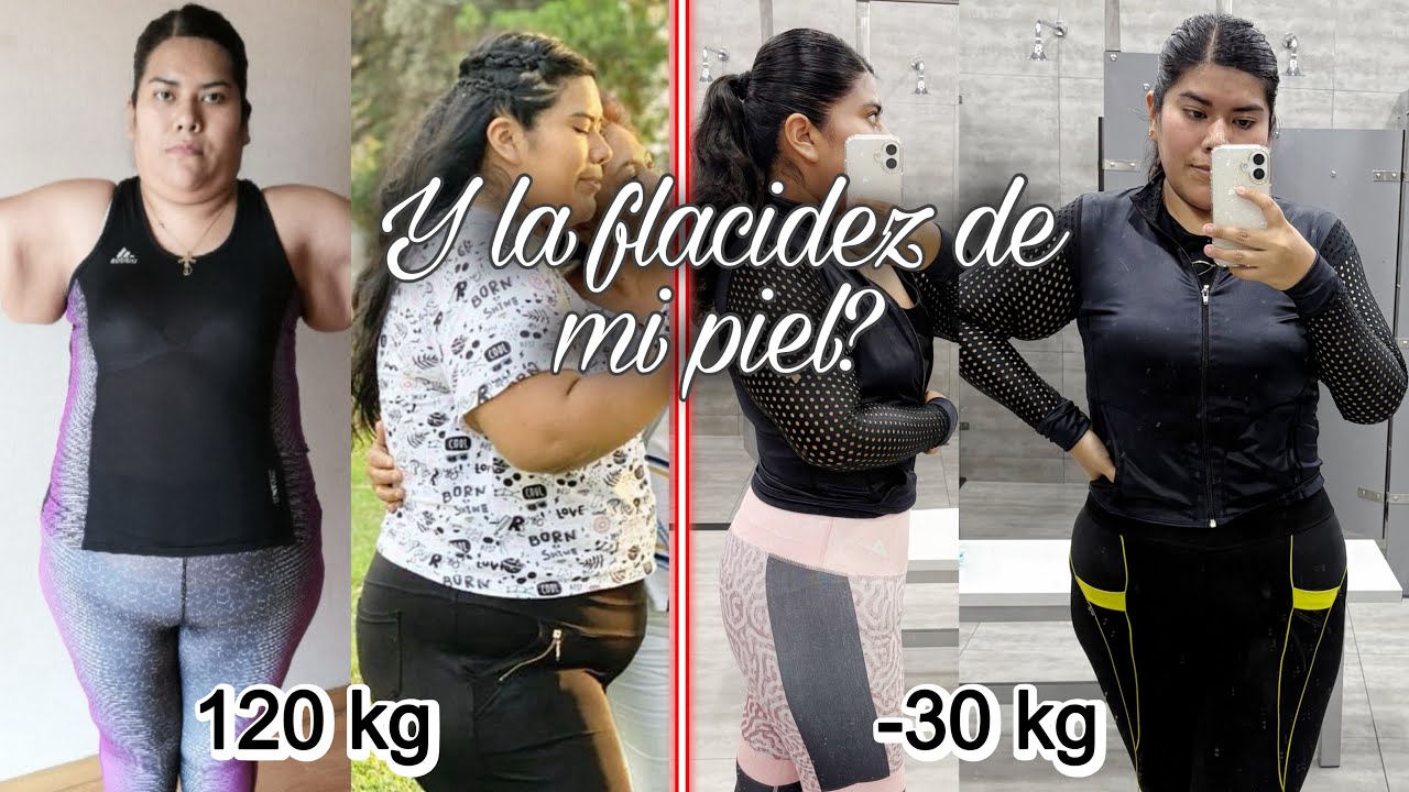 Bajé 30 kILOS y así quedó mi CUERPO (sin filtros) ❤️‍🩹 No BAJABA de PESO por MIEDO a esto 😔| Arlessy