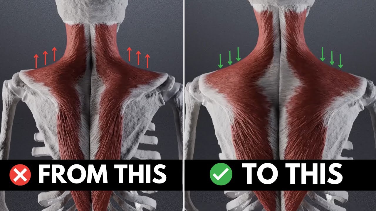 How To (actually) Fix Tight Upper Traps