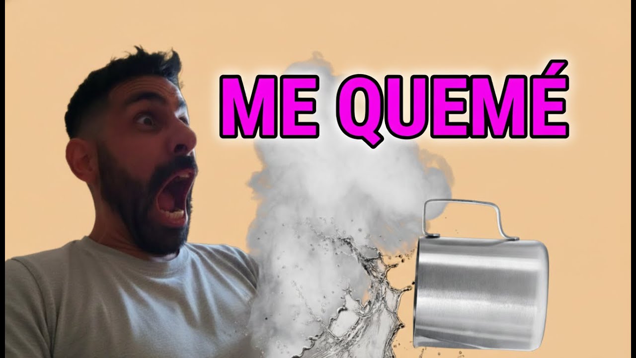 STORY TIME // ME QUEMÉ LA INGLE