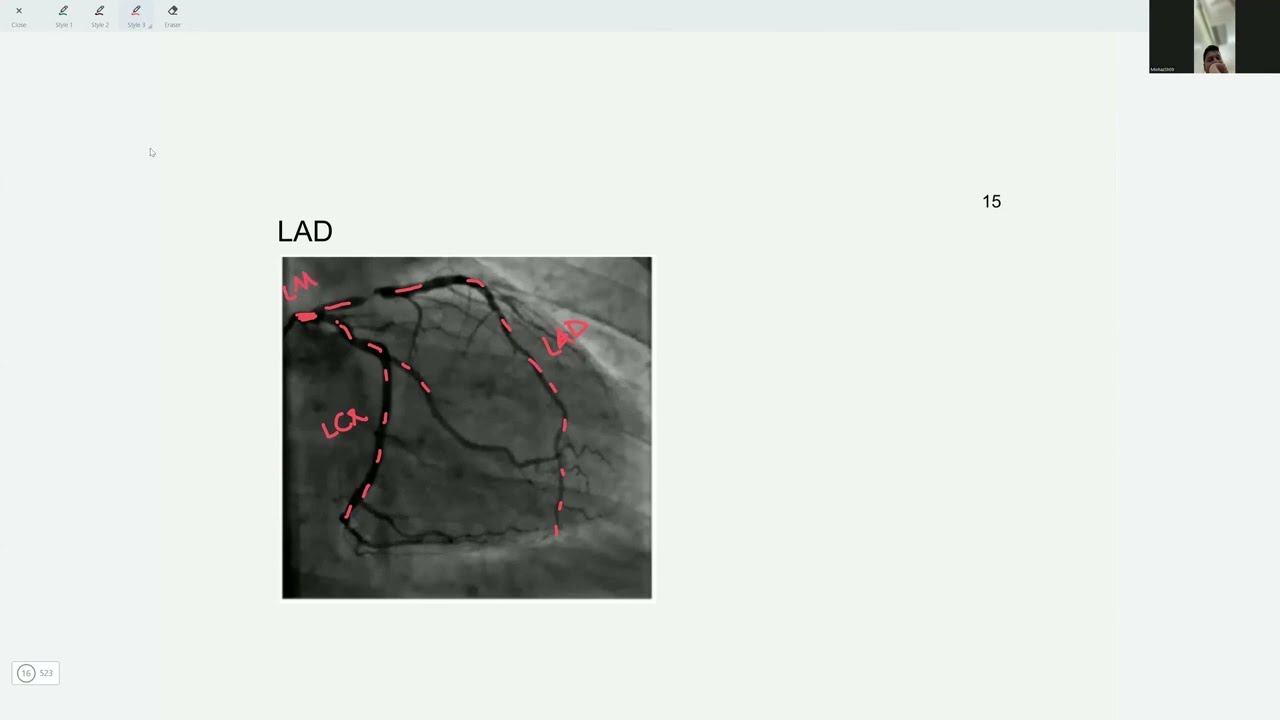 Med-Sparkle MRCP part 2 Course: Session 1 (Cardiology)