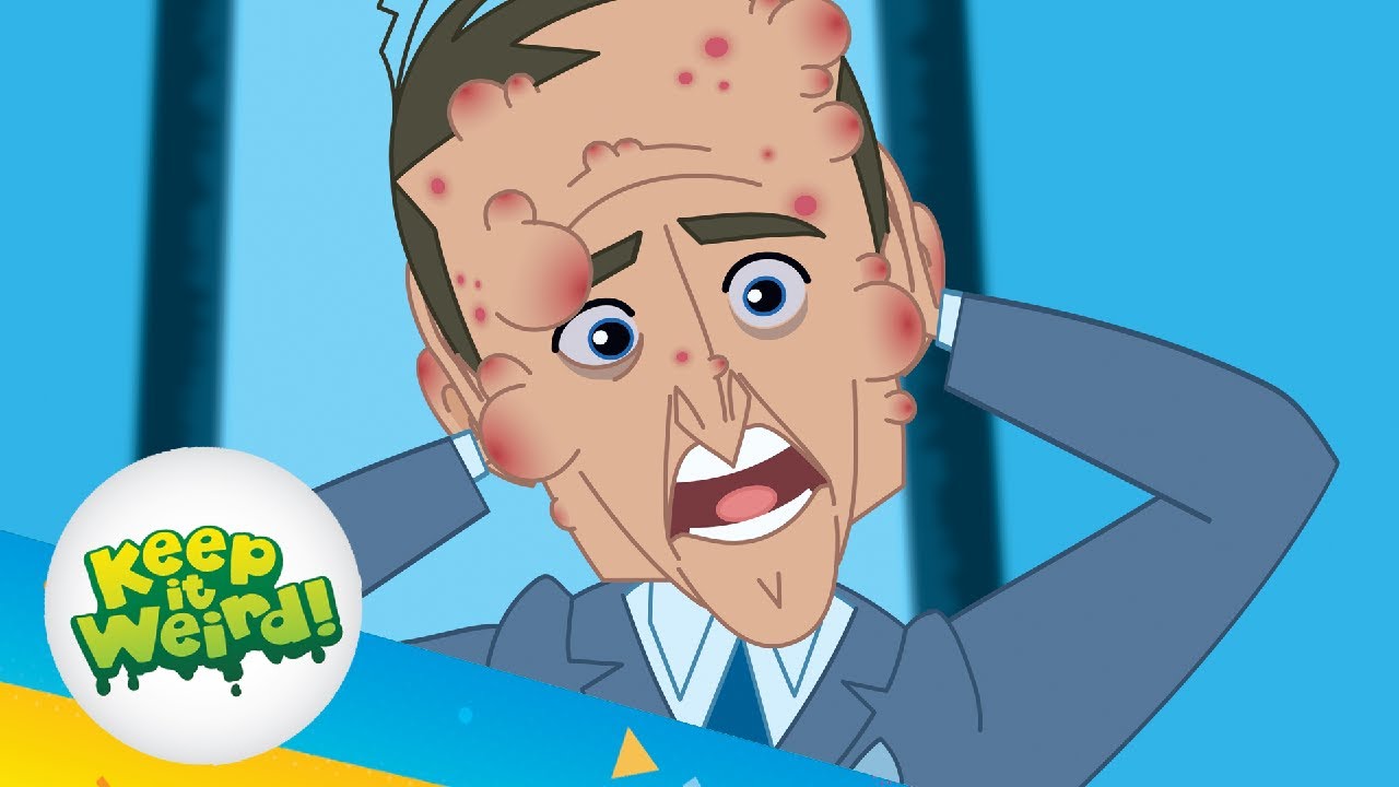 Grossology: When Allergies Attack - Ep.34