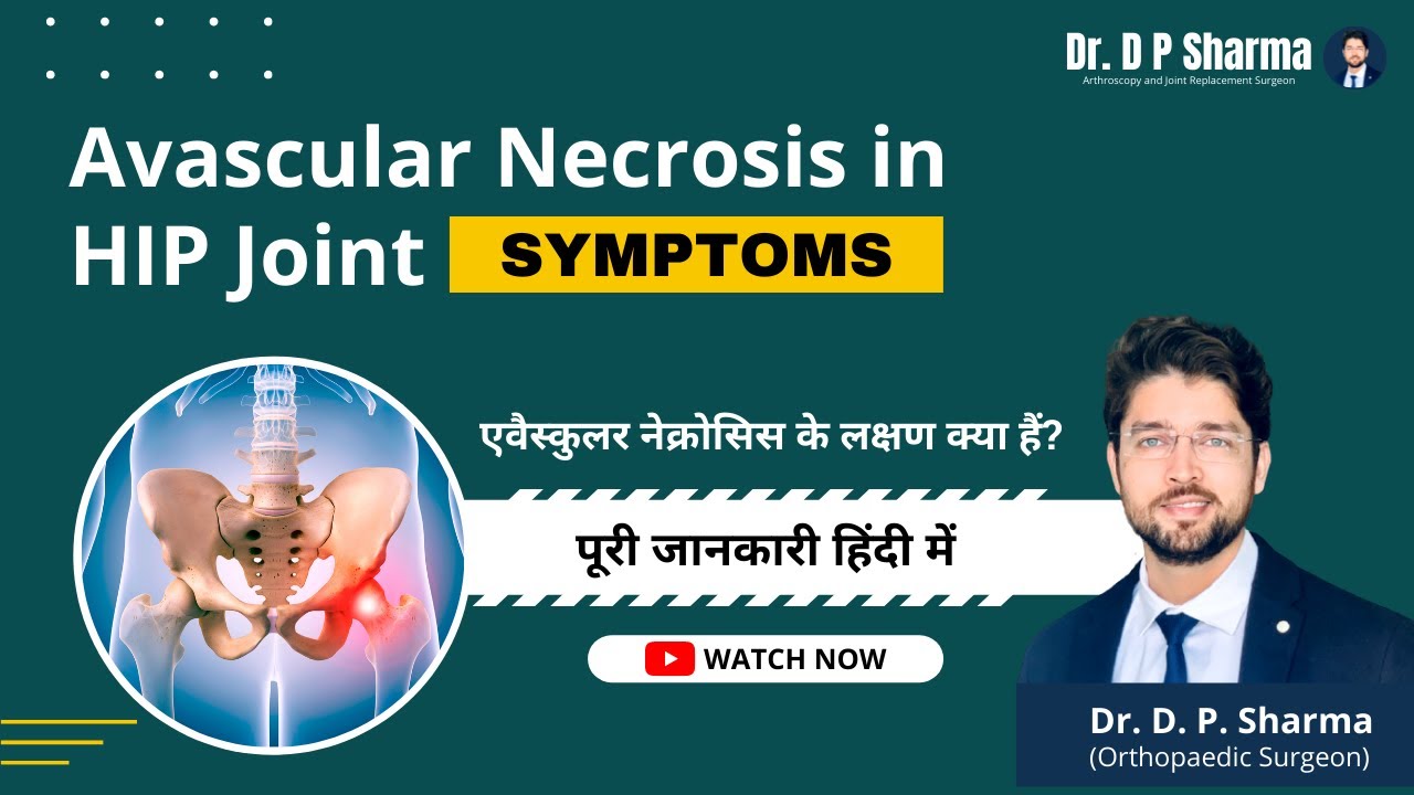 HIP AVN Symptoms Explained in Details | Avascular Necrosis of Hip Joint Treatments in Agra, India
