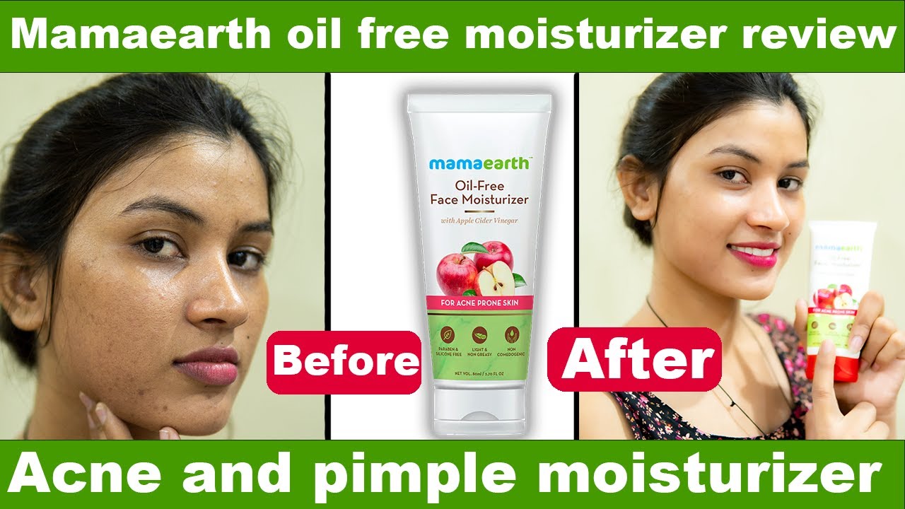 Mamaearth Oil Free Moisturizer with Apple Cider Vinegar Review | Oily Skin, Acne Prone ✅