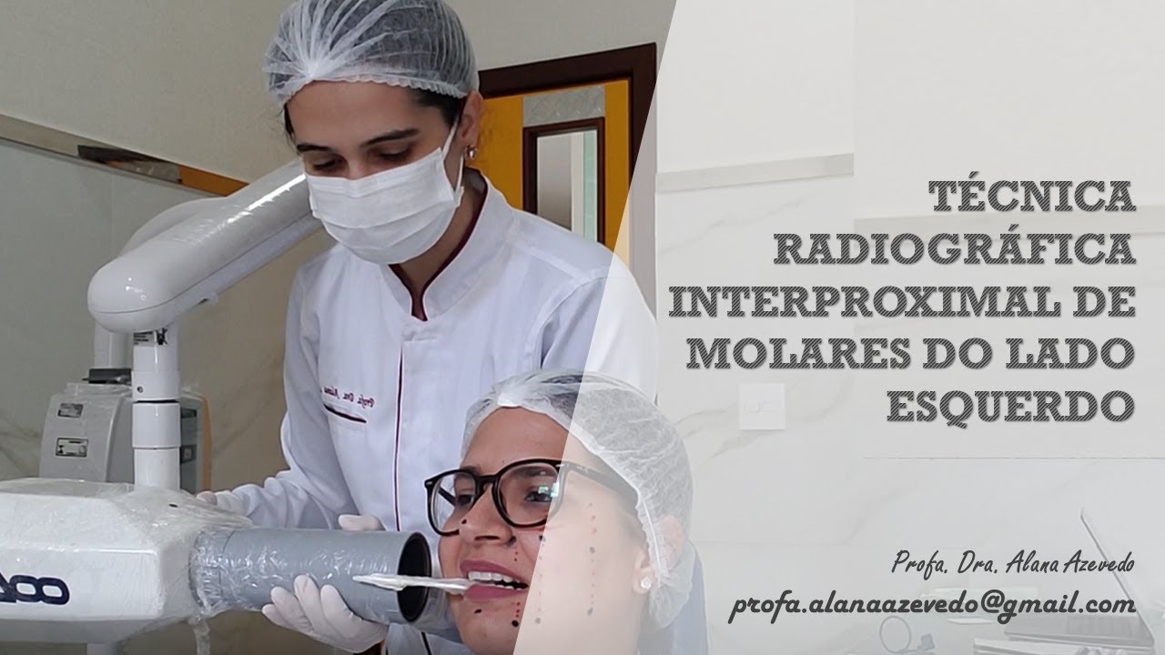 Técnica radiográfica interproximal de molares do lado direito