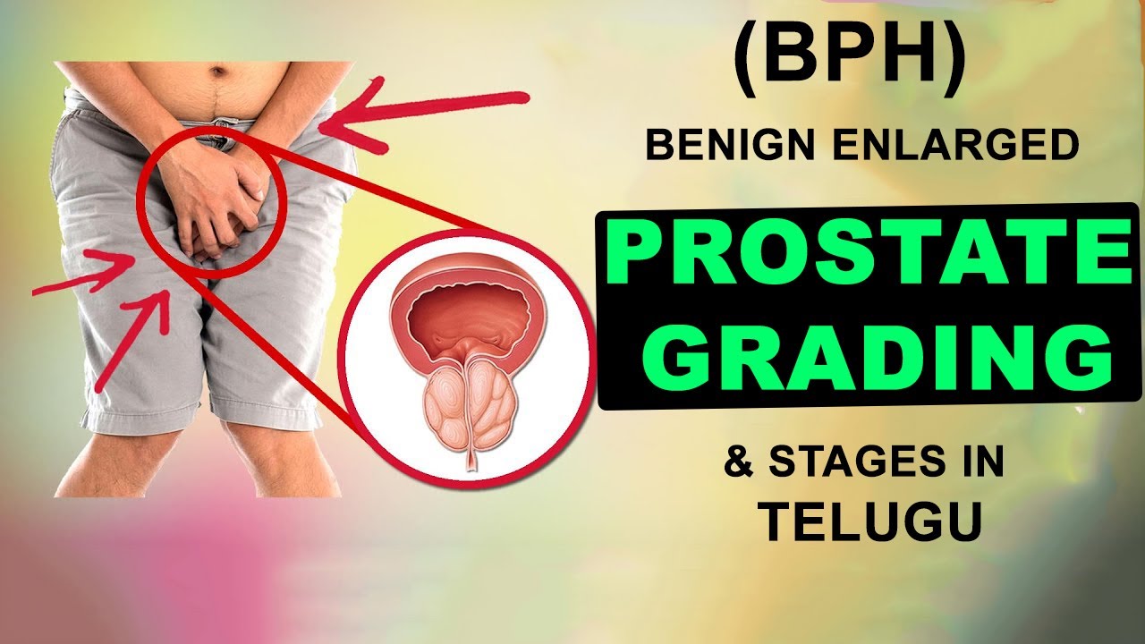 Benign Enlarged Prostate (BPH) Grading and Stages in Telugu i  STAGE 1 I STAGE 2 I STAGE 3 I