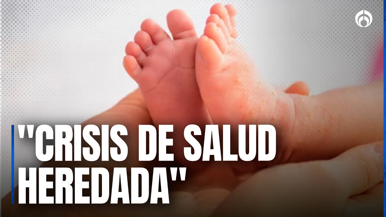 México líder en sarampión: especialista explica la causa real