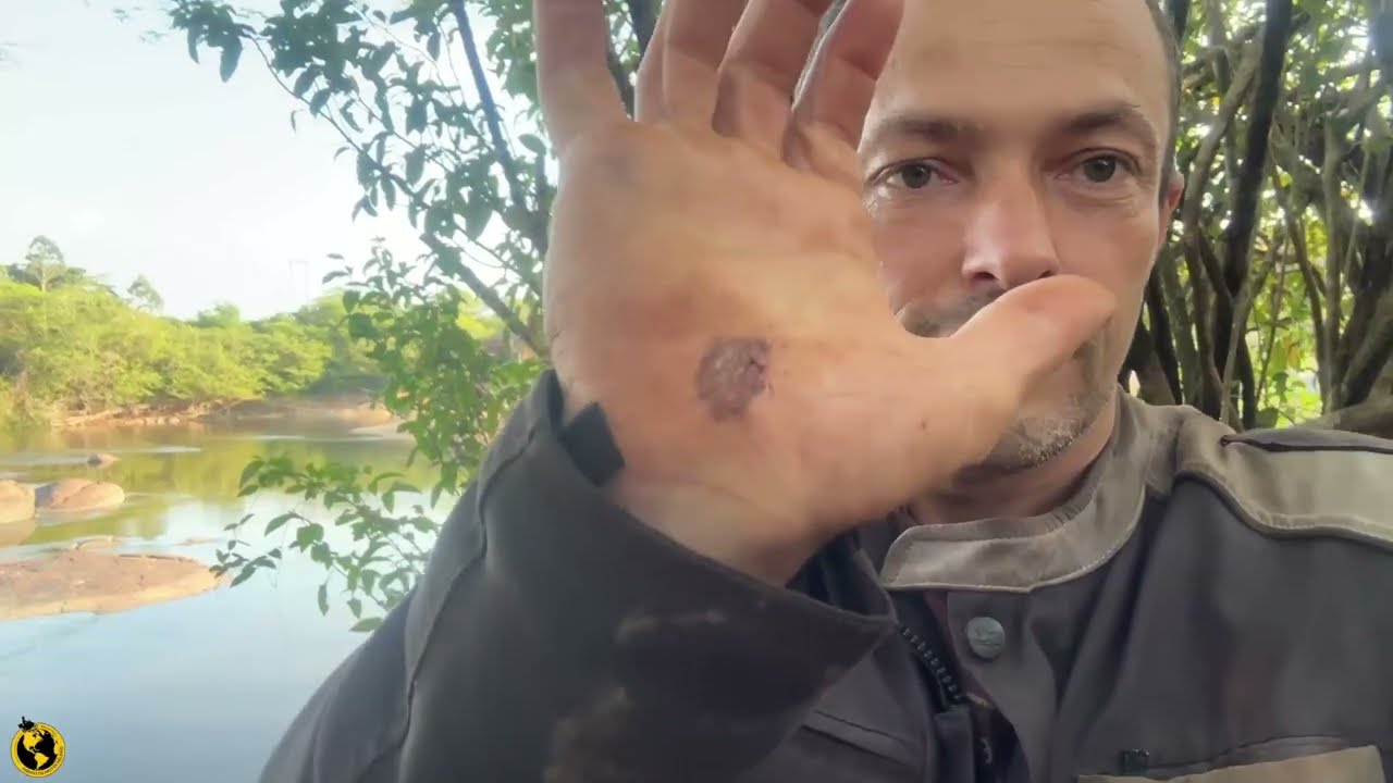 FUI PICADO NO ACAMPAMENTO  RORAIMA  T11EP34