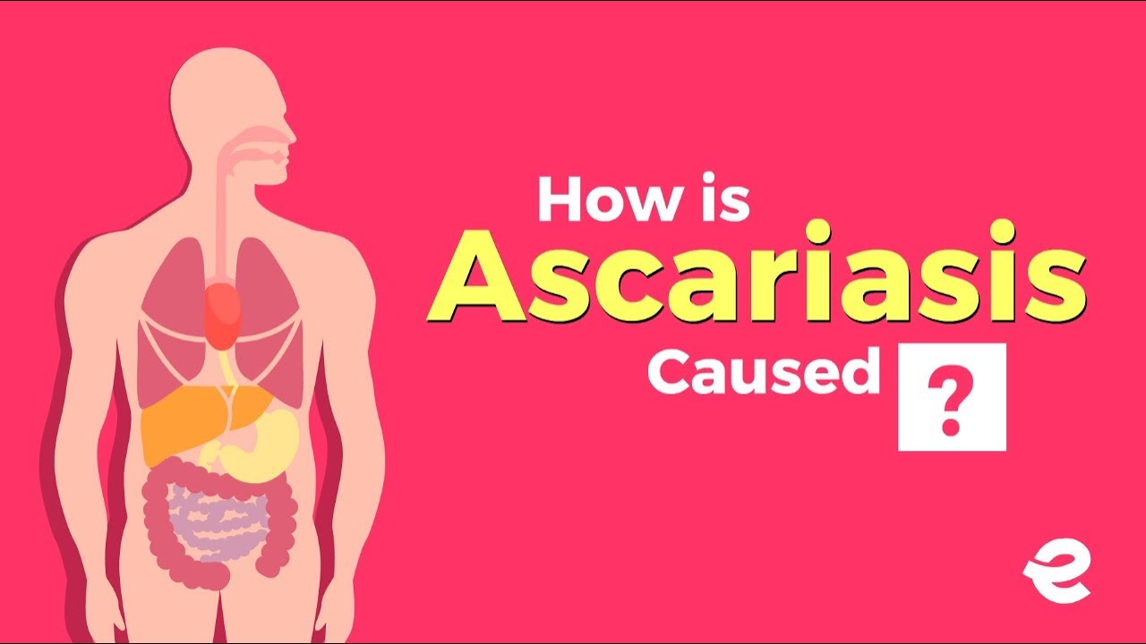 Ascariasis - Human Health & Diseases | Biology | Extraclass.com