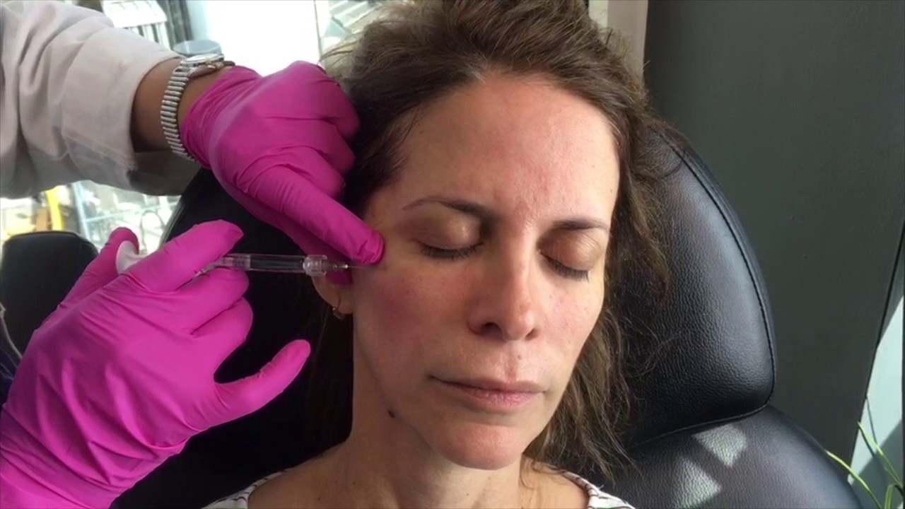 Belotero Under Eye Filler