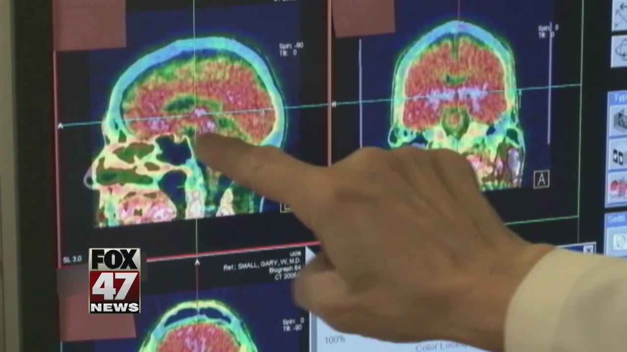 'Return to learn' concussion guidelines