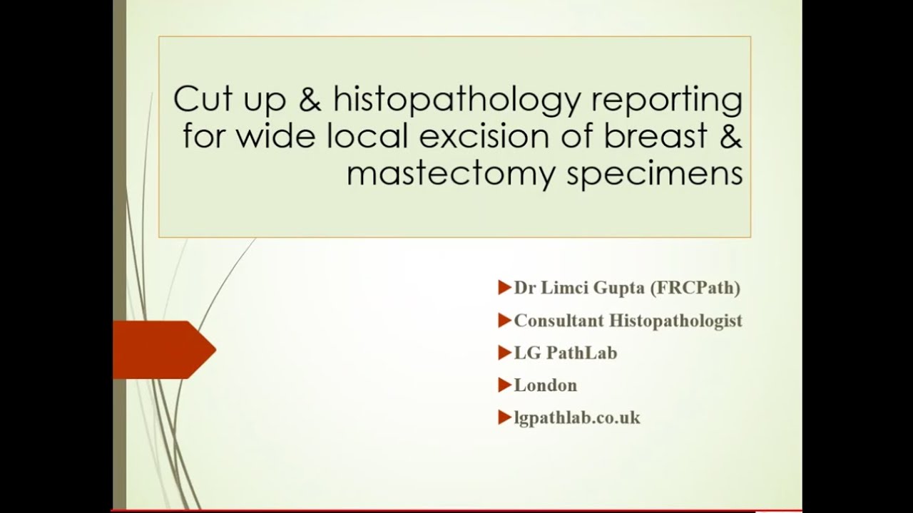 LG PathLab webinars: Breast cut up and microscopic reporting - Dr Limci Gupta