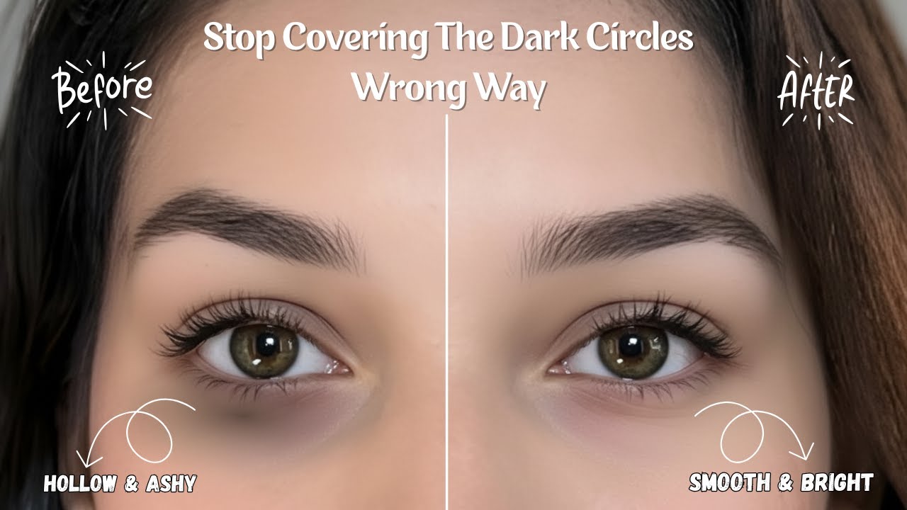 Stop Covering The Dark Circles Wrong Way