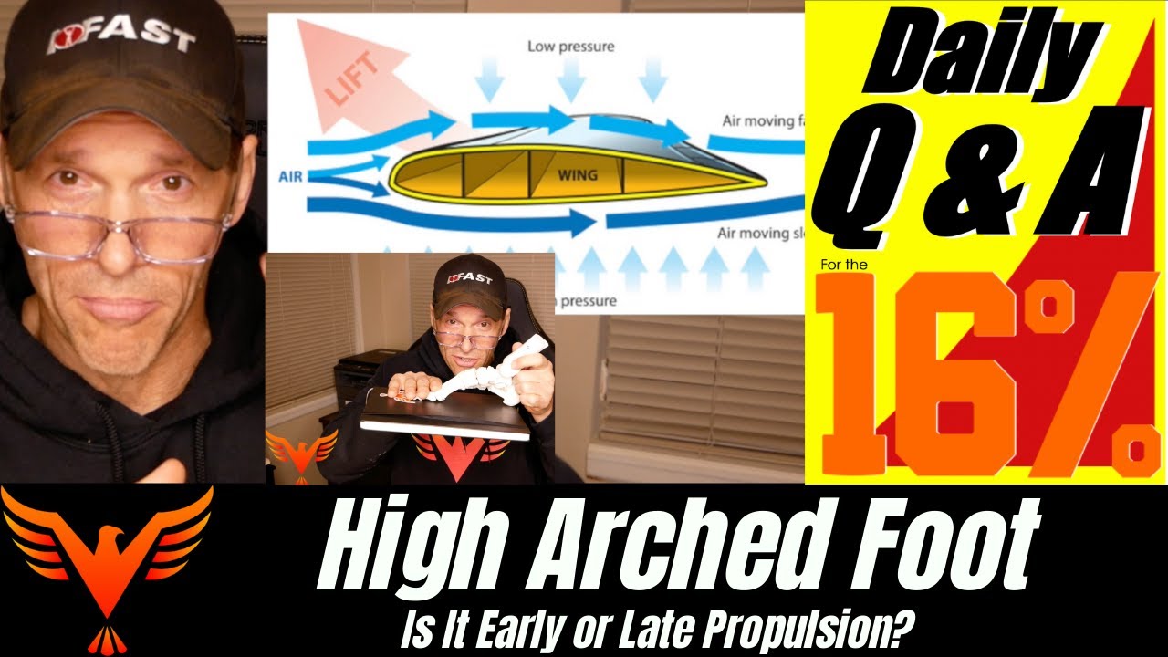 Q & A for The 16% - Case Study:  High Arched Foot - Early or Late Propulsion?  - BillHartmanPT.com