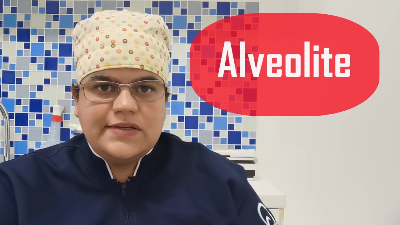ALVEOLITE o que é? Como EVITAR? ComoTRATAR? | Dra Bianca Rosa