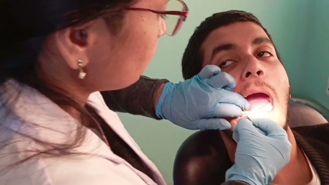 Fixing Cap on Tooth | Crown Fixing Teeth | Dr. Archana Rani | Patna Best Dentist