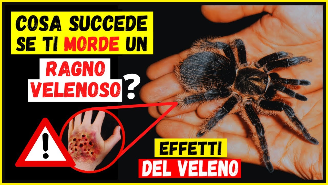 Cosa succede se ti morde un ragno velenoso? Effetti del veleno sull'organismo - Cose che non sai