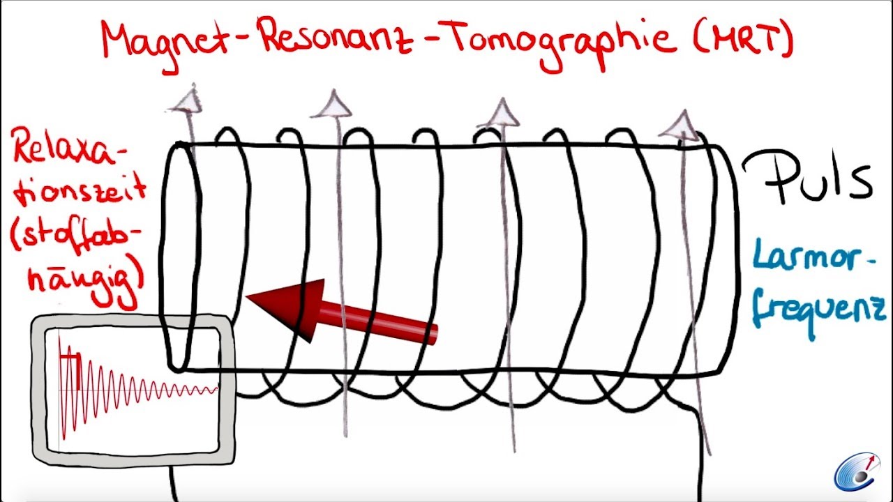 Das MRT-Signal